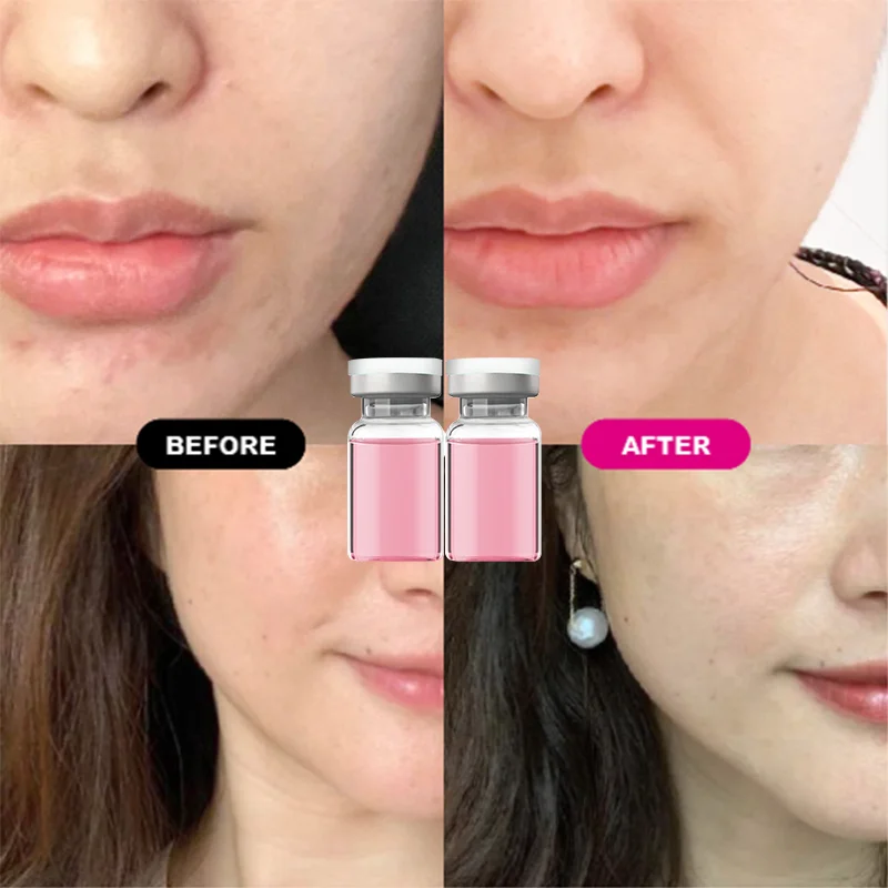 Уход за кожей лица 135-HA Essence Care Кожа Блеск PD-RN Увлажняющая и увлажняющая эссенция