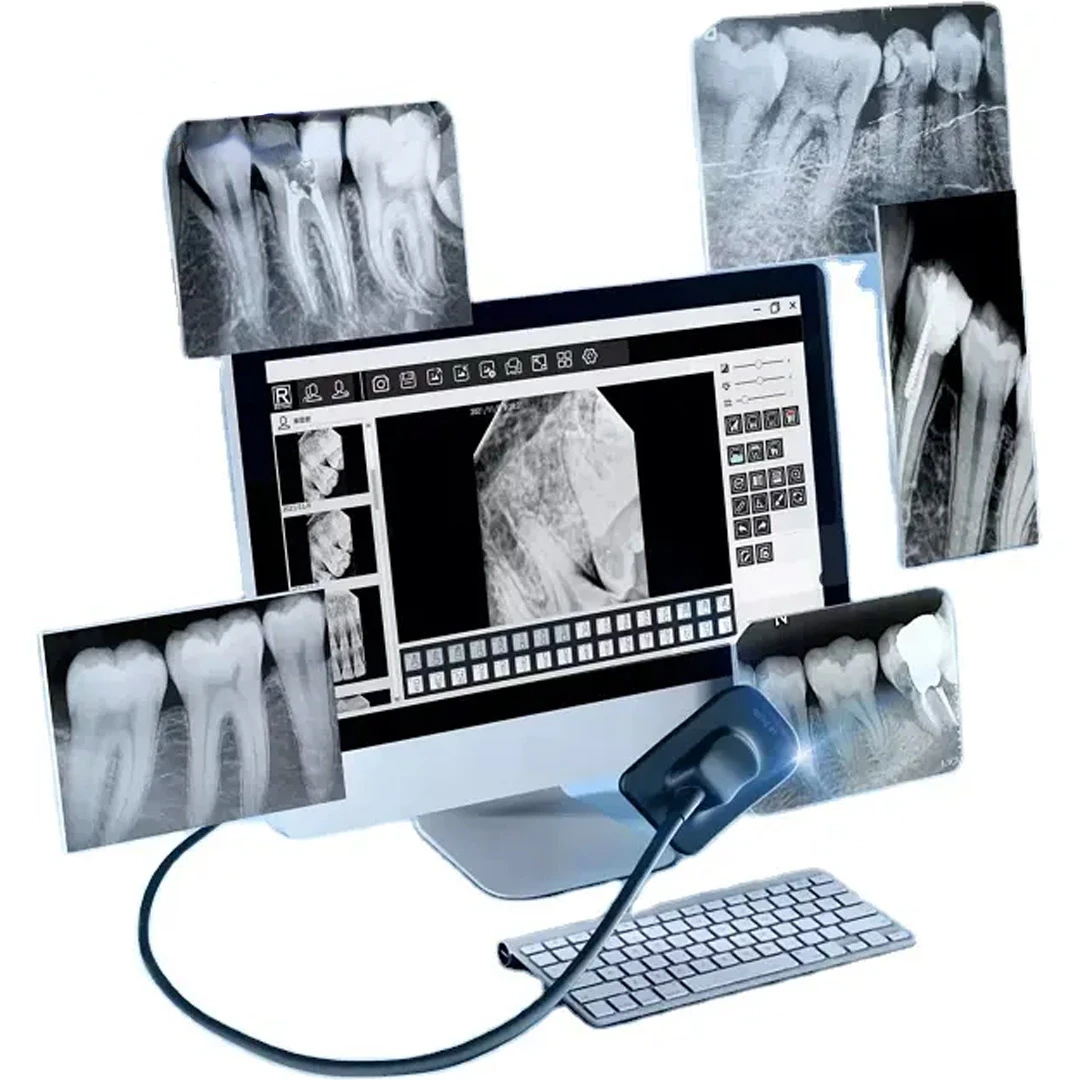 

CE, стоматологическая визуализация, отсутствие излучения, поддержка RVG, Twain apтерикс, система рентгеновского излучения для полости рта R1 R2, Датчик изображения для использования стоматологического изображения