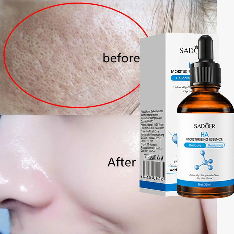 

Hyaluronic Acid Shrink Pores Face Serum Arbutin Whitening Beauty Skin Care Remove Dark Spots Firming Brighten Korean Cosmetics