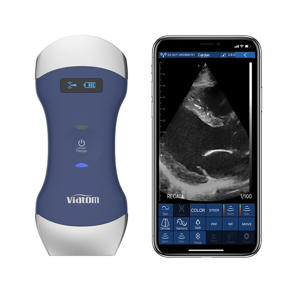 Viatom Wifi Ultrasound Probe Sonosite Wireless Digital Scanner Human Therapy Handheld Portable Ultrasound Machine