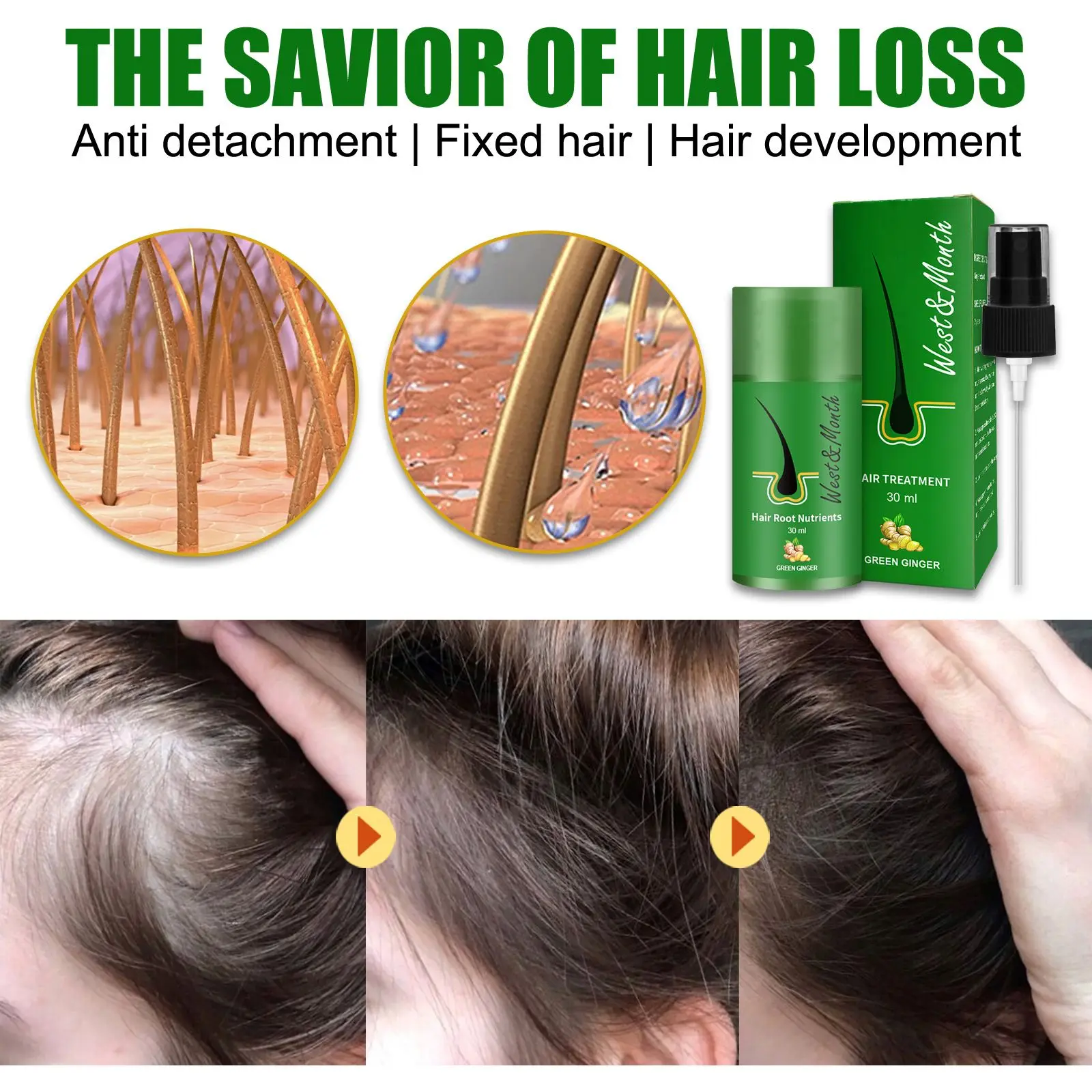 

30ML Hair Regrowth Spray Hair Root Nutrients Germinal Treatment Serum Haircare Hair Loss Baldness Repair Pilatory Unisex