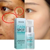 nicotinamide whitening freckle cream dark spot remover moisturizing brighten pigment correction face beauty skin care