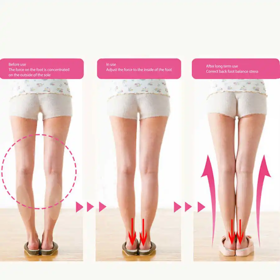 Чтобы ноги были ровные. Чтобы ноги были ровные. Чтобы ноги были ровные. Кривые женские ноги. Ровные женские ноги.