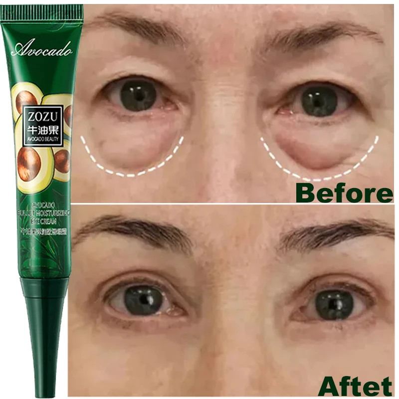 

Instant Remove Wrinkles Eye Cream Anti Dark Circles Bags Puffiness Fade Eye Fine Line Tighten Whiten Under Eyes Skin Korean Care