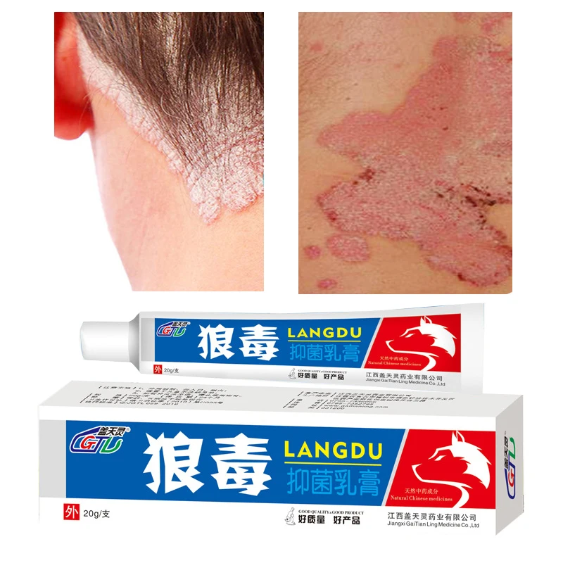 

Antibacterial Cream Psoriasis Ointment Herbal Treatment Fungal Eczema Itching Relief Rash Urticaria Scaling Body Skin Care