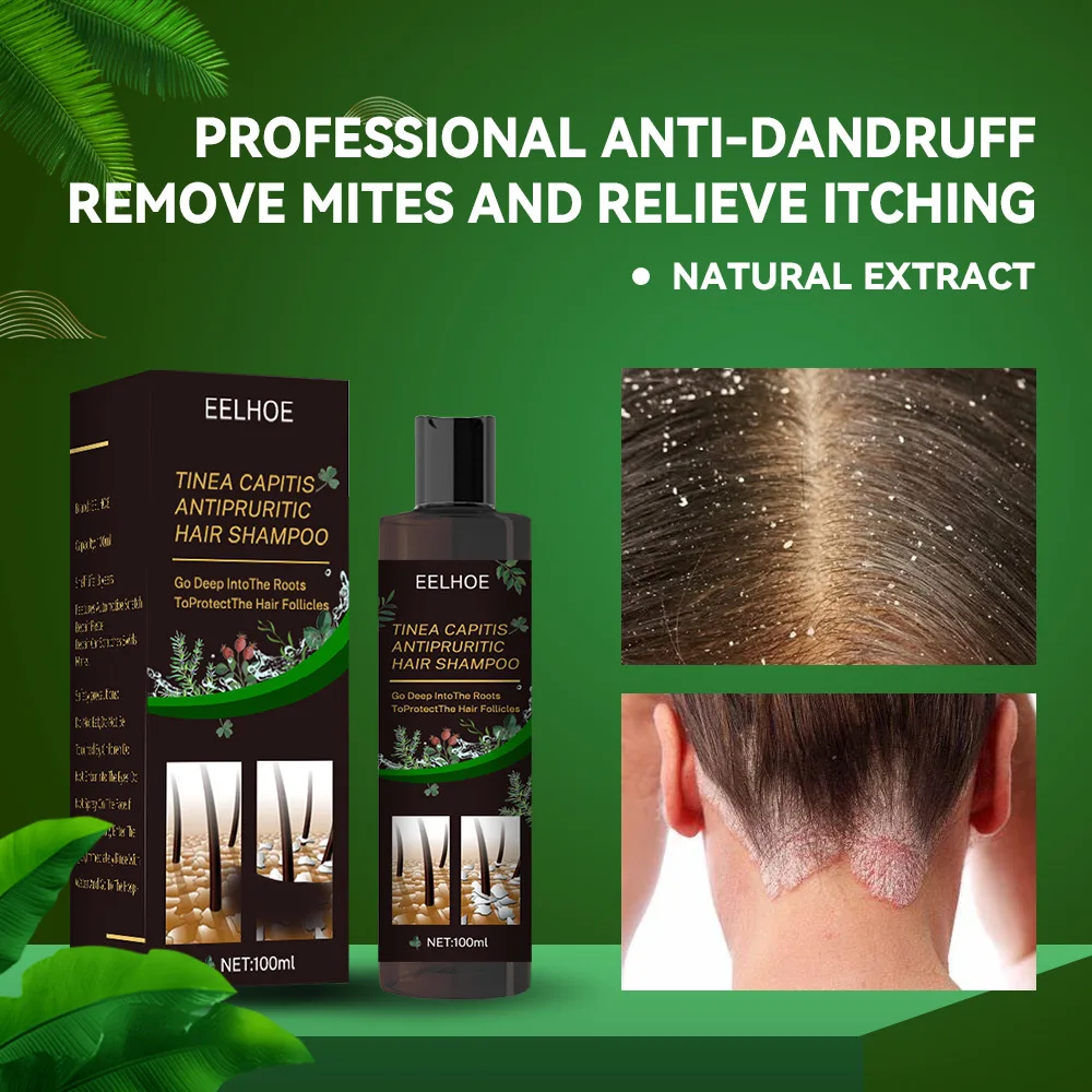 Dispel Tinea Capitis Dispel Dandruff Control Oil Relieve Itching Prevent Oil Loss and Control Refreshing Shampoo itch scalp
