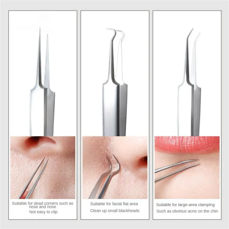 

Blackheaded Tweezers Clean Good Resilience Acne Removal Needle Tool Beauty Tools Skin Care Tools Facial Skincare Tools Acne Clip