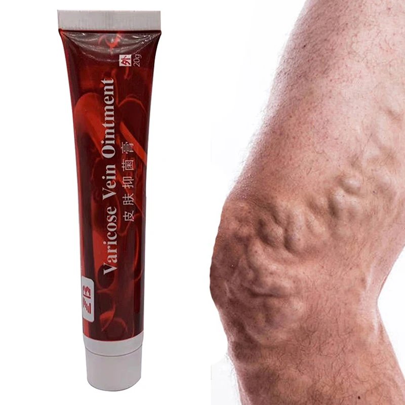 

Мазь для лечения варикозного расширения вен, 30 г