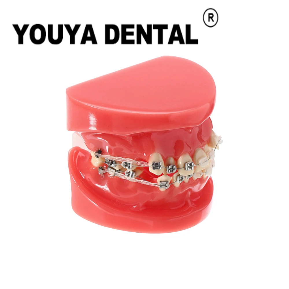 

Ортодонтическая модель детской зубы с металлическим кронштейном, скобы для дантиста, технического специалиста, студента