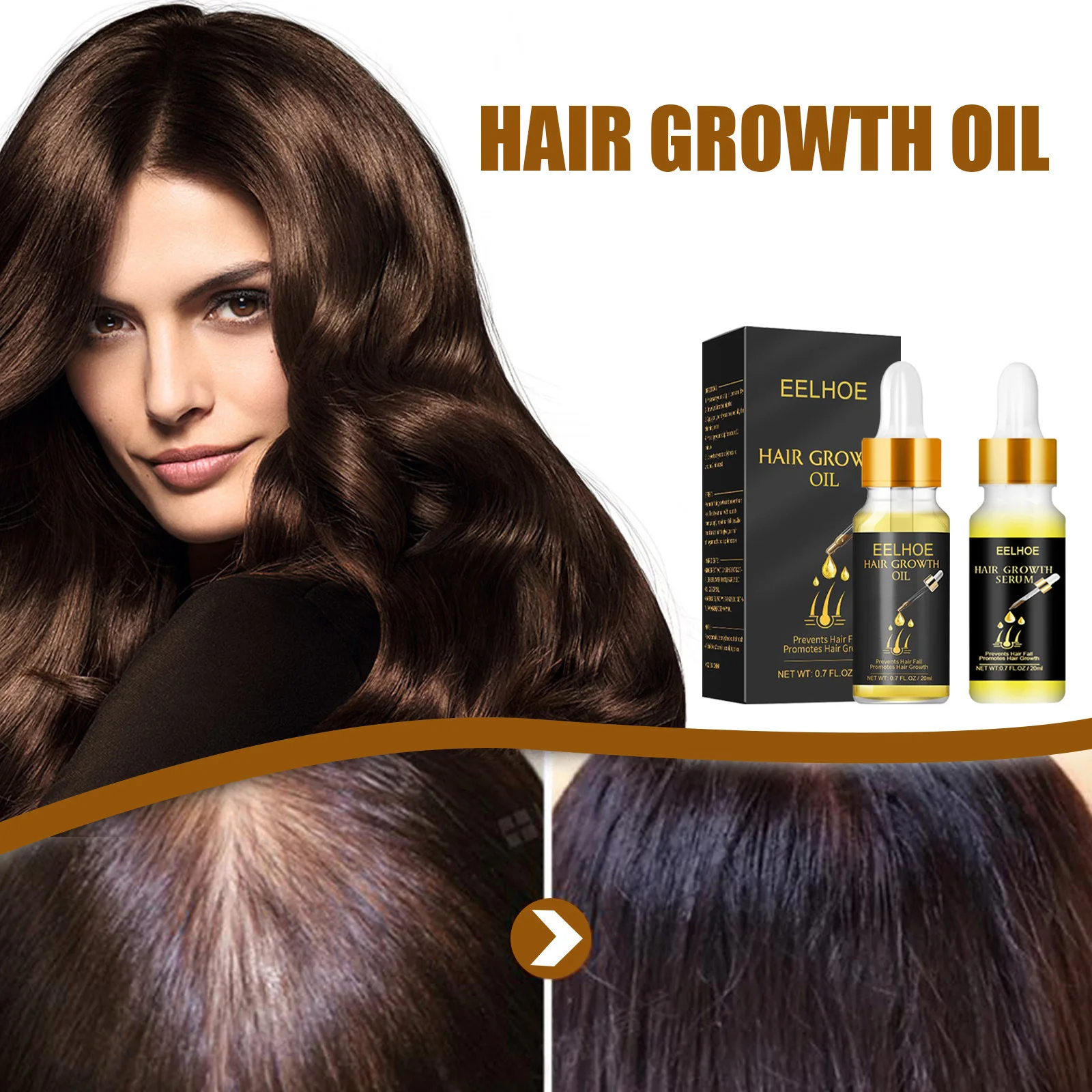 EELHOE 20ml Hairdressing Ginger Hair Oil Accelerate Hair Growth Hair Nourishing Liquid Care Liquid Free Shipping