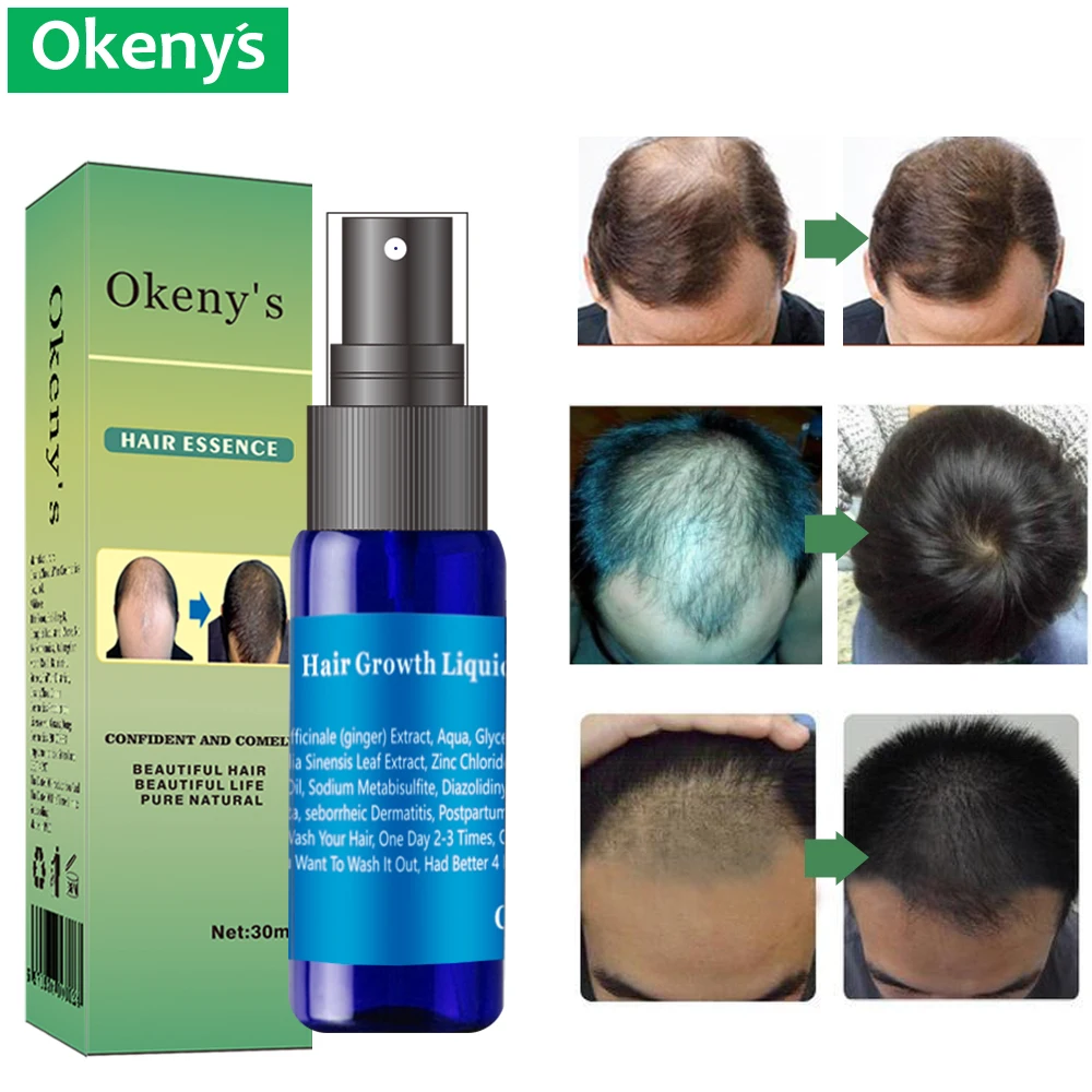 

Эссенция для роста волос с имбирем Андреа, масло для быстро расти, плотное восстановление, средство против выпадения волос Sunburst Alopecia для муж...