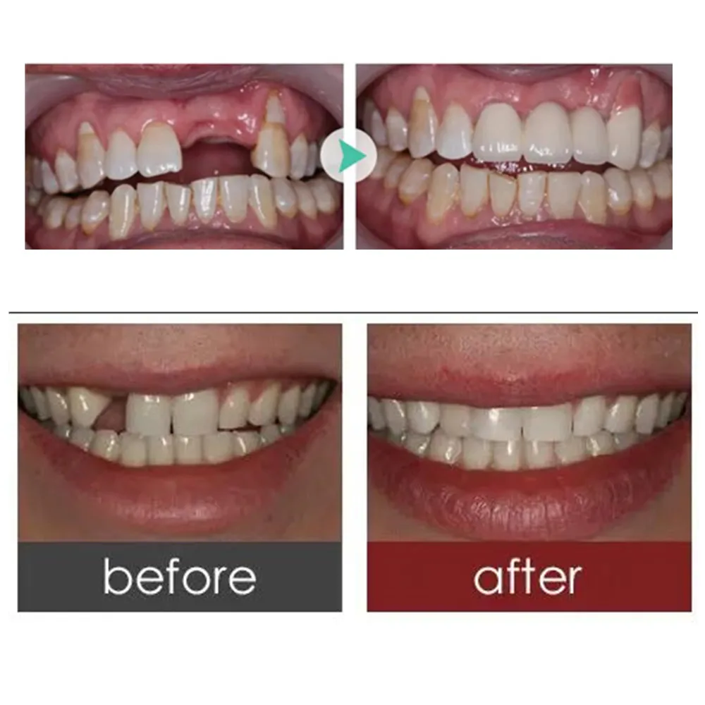 Набор для ремонта зубов SowSmile стоматологическая имитация полости рта 3-го