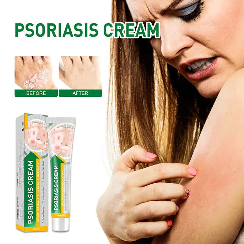 

2Pcs 20g Skin Care Ointment Body Treatment Itchy Cream