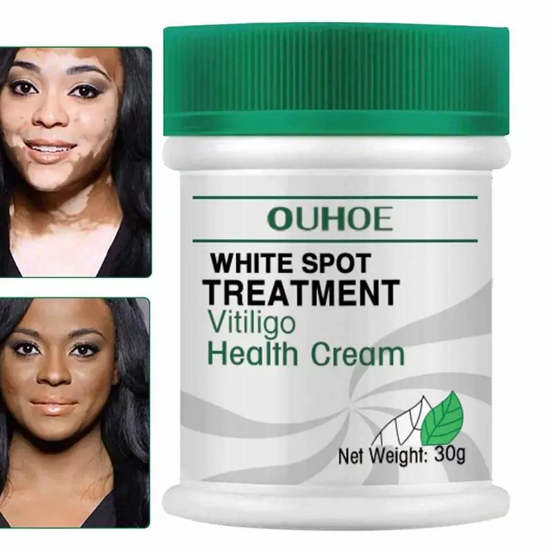 

White Spot Repair Cream 30g Whitening Cream Remove White Spots Fade Sweat Spots Cream Moisturizing Lifting Repair Skin Care