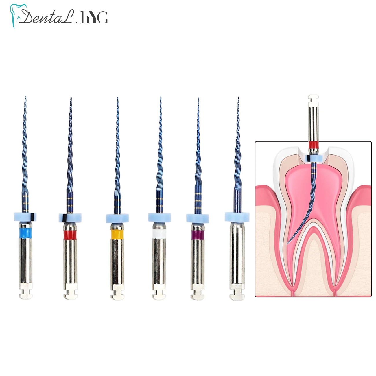 6pcs/Box Dental Heat Activated Canal Root Files SX-F3 21mm Dentist Tools Can Bend for Preparing Root Canal Treatment