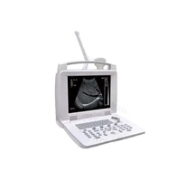sy a005 12 inch full digital portable bw ultrasound scanner with best price