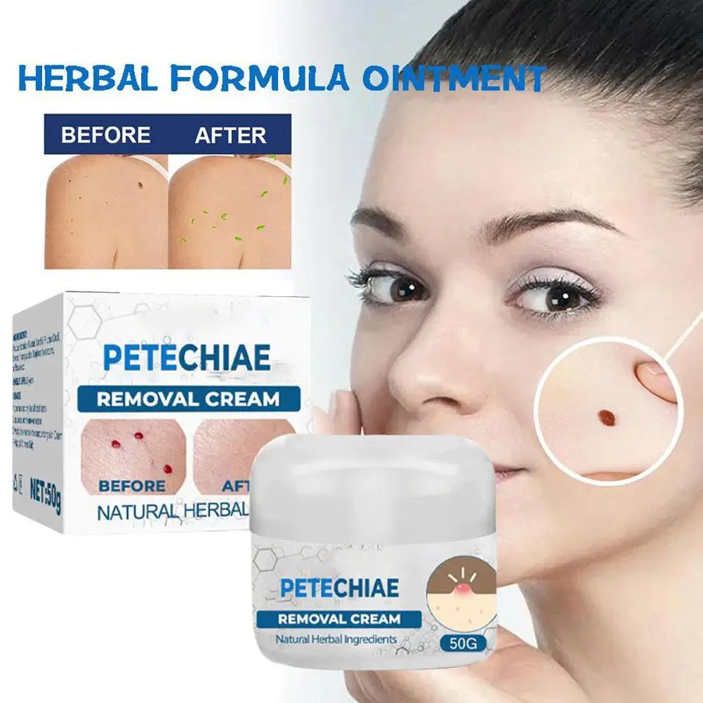 

Acne Face Cream Herbal Pimple Scar Removal Shrink Pore Oil Control Moisturizing Facial Cream Acne Treatment Skin Care