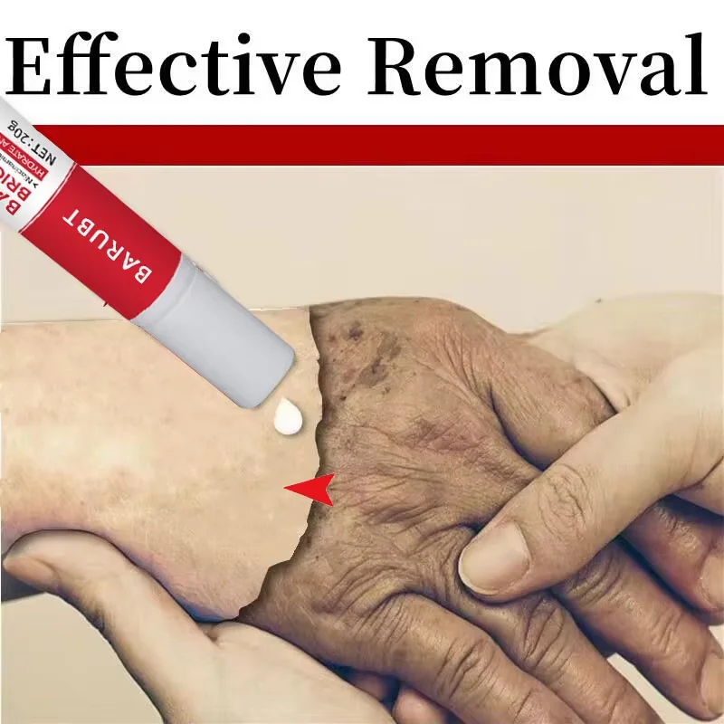 Отбеливающий крем-сироватка от веснушек удаление темных пятен мелазма