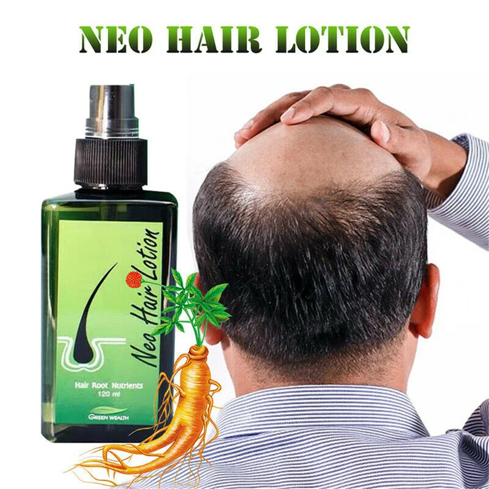 

Лосьон для волос Neo, средство для филировки и роста, питательные вещества для корней против выпадения, оригинальное натуральное таиландское масло для ухода за волосами, 120 мл
