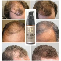 purc hair growth oil fast hair growth products scalp treatments prevent hair loss thinning beauty hair care for men women 2 h2p2