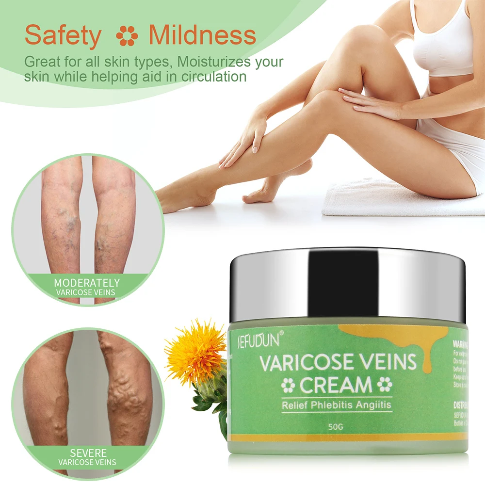 

Крем для облегчения варикозного расширения вен, лечение васкулита, флебита, спайдера, облегчения боли в ногах и быстрой циркуляции крови