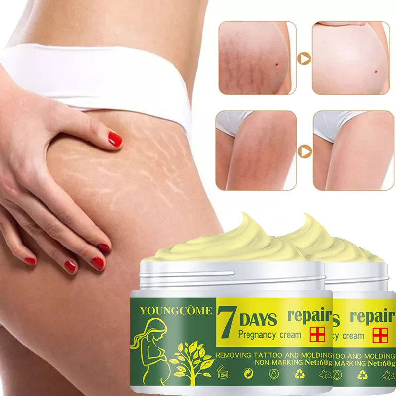 

Pregnancy Repair Cream Stretch Mark Removal Removal Acne Scar Stretch Marks Cream Fat Striae Gravidarum Treatment Body Creams
