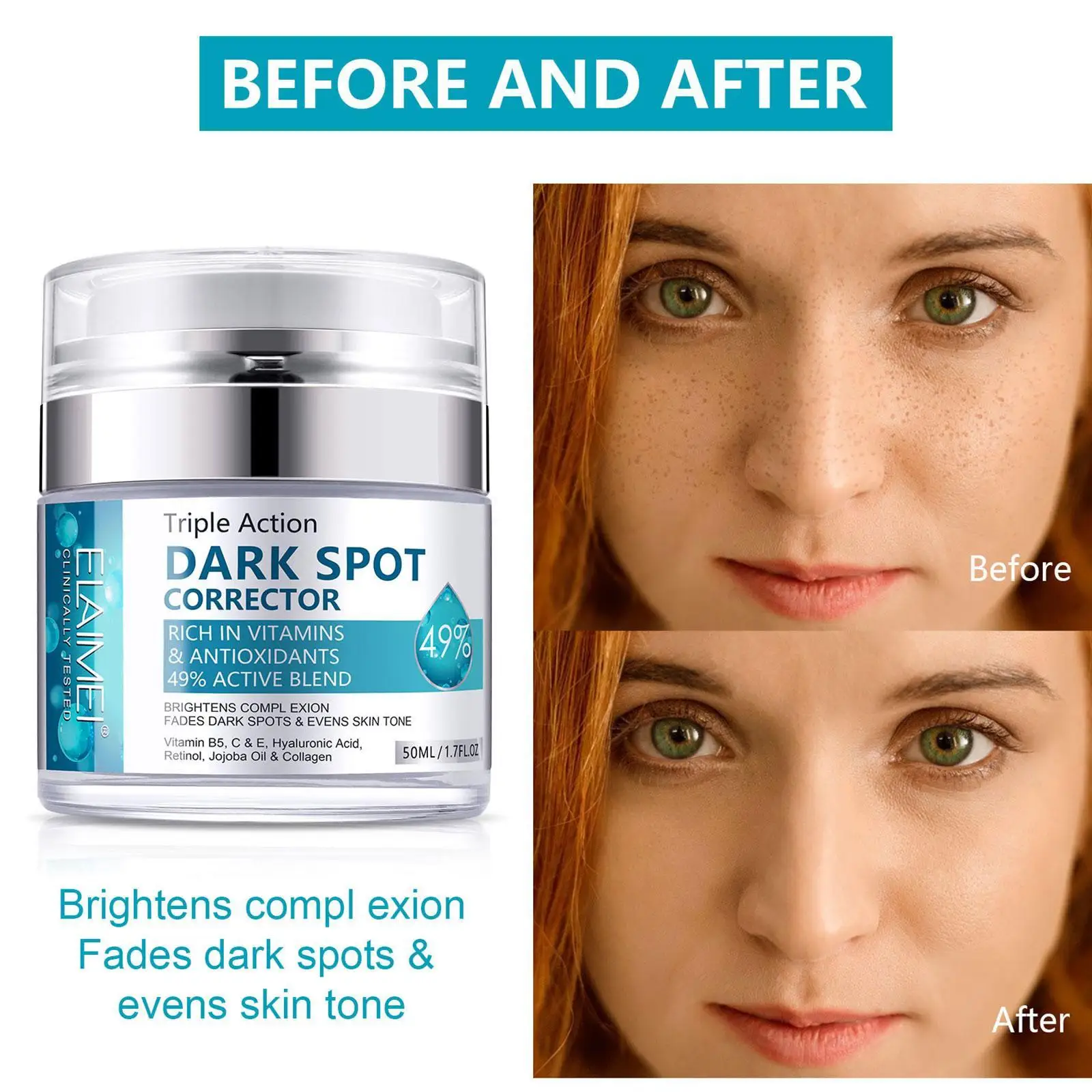

50ml Dark Spot Corrector Cream Anti-Aging Dark Spots Freckles Removal Skin Repair Face Moisturizing Brightening Cream Skin Care