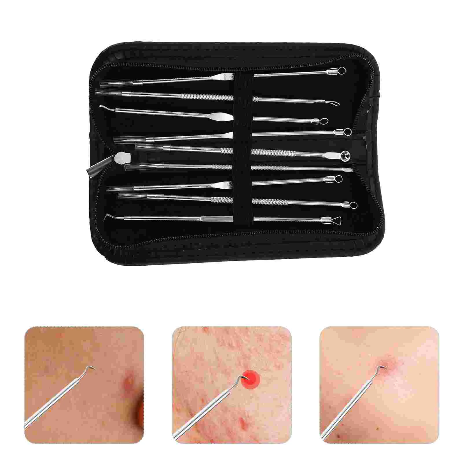 

Tool Extractor Pimple Pore Comedone Zit Removal Blackhead Double Endwhitehead Popping Beauty Needle Kit Deep Care Skin Face