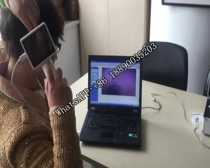 

3.5 Inch LCD Screen Digital ENT Endoscope Series With Any 2 lenses (Ear/Nose/Throat lens )