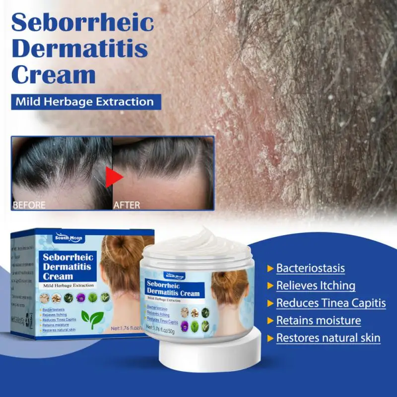 

50g/Box Itchy Skin Cream Non-irritating Healthy Safe Effective Anti-inflammatory Head Seborrheic Dermatitis Cream For Scalp