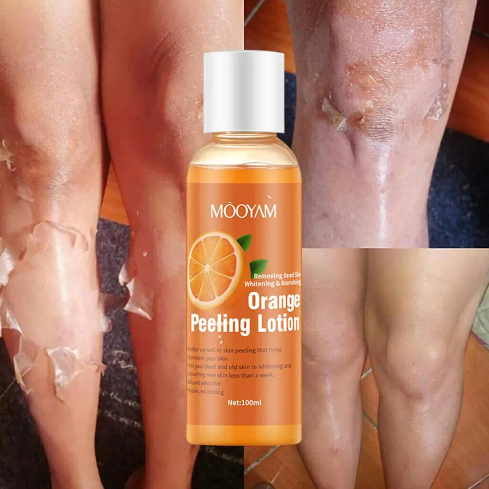

Yellow Peeling Oil Bleaching Dark Skin Lighten Elbows Hands Whitening Serum Tone Skin 100ml Effective Even Body Knees J0W3
