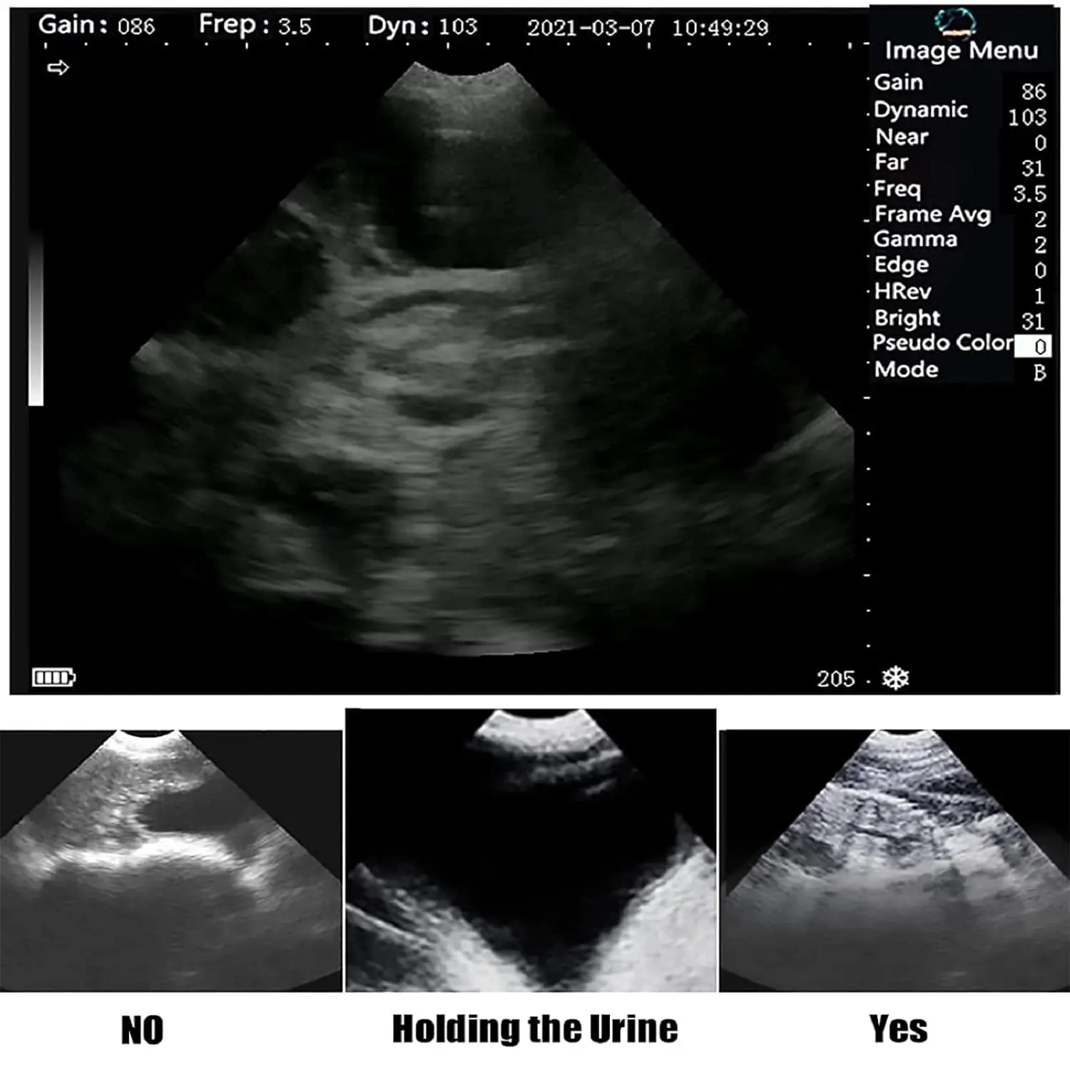 Ветеринарный B-ультразвуковой механический зонд для ультразвуковой машины овец