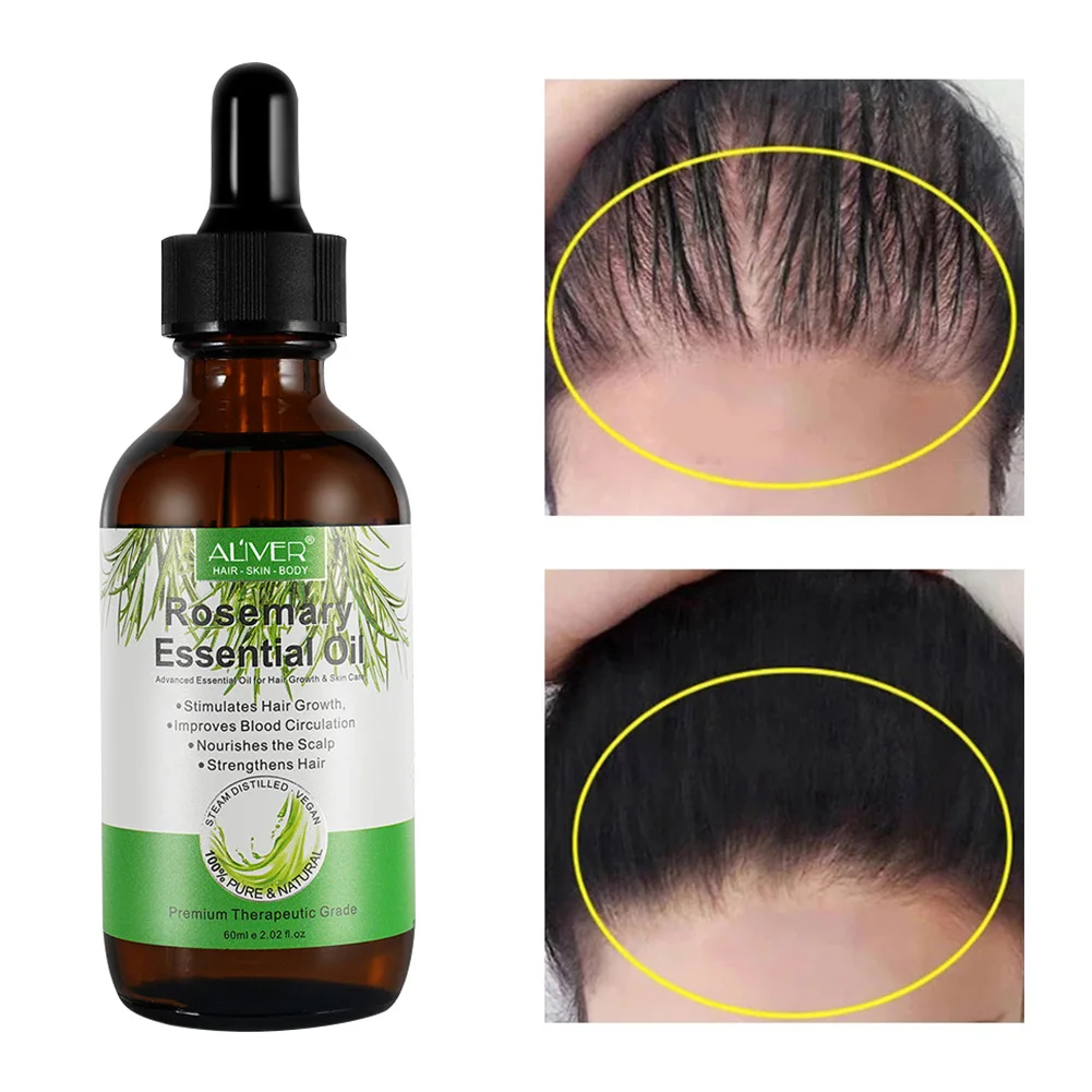 

Rosemary Hair Growth Serum Anti Hair Loss Products Fast Regrowth Essential Oil Repair Scalp Frizzy Thinning Damaged Hair Care