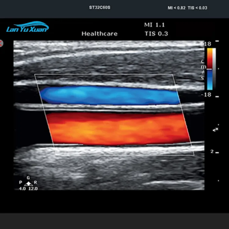 Рисунок 4 - Портативный цифровой цветной допплер