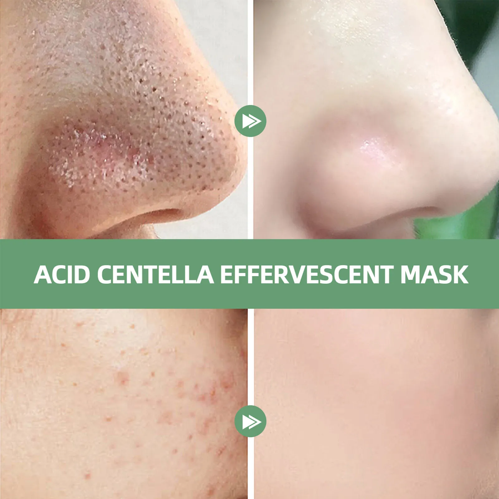 Увлажняющая маска для лица Centella Asia Fack Pack увлажняющая кожи удаления черных точек