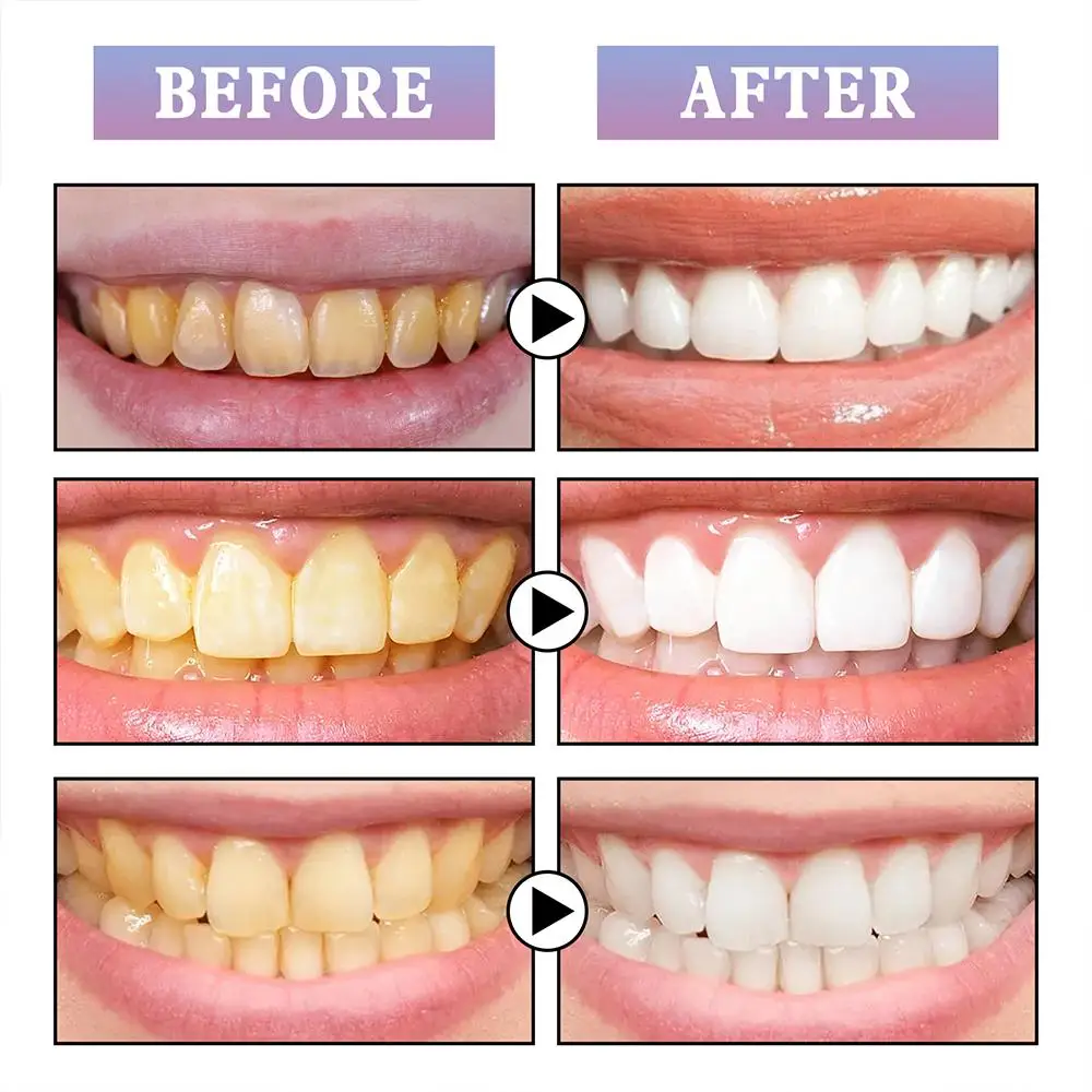 Рисунок 5 - зубная паста