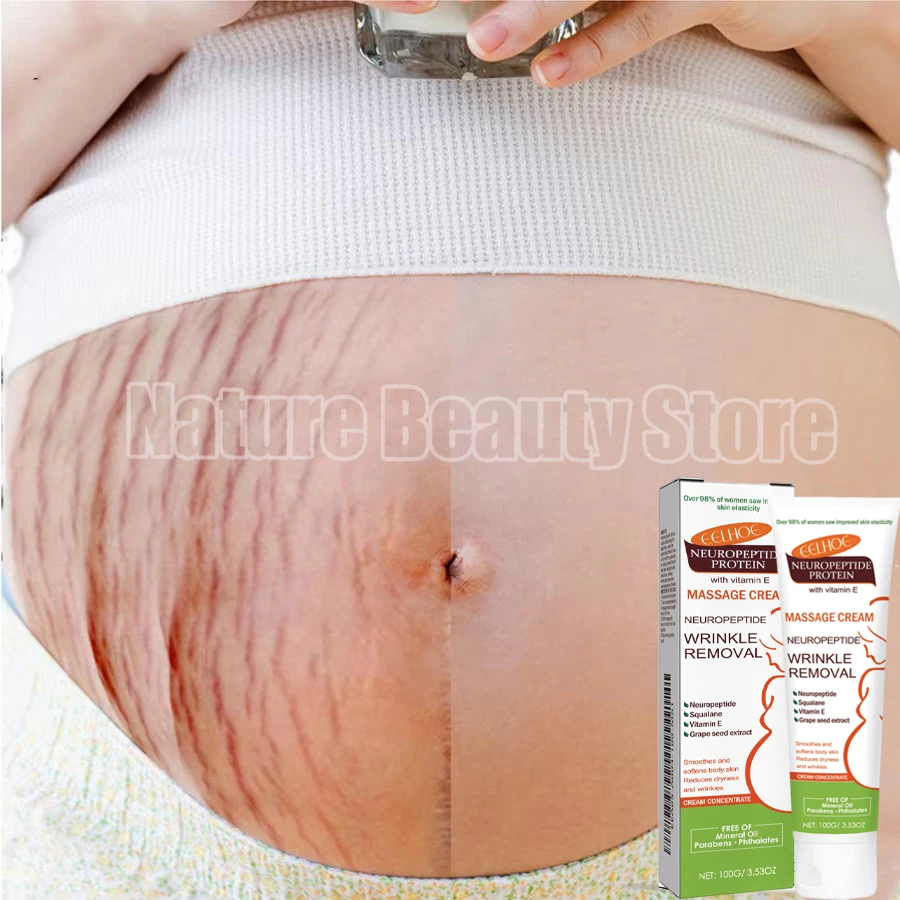 Крем для удаления растяжек восстановление беременных женщин антивозрастной