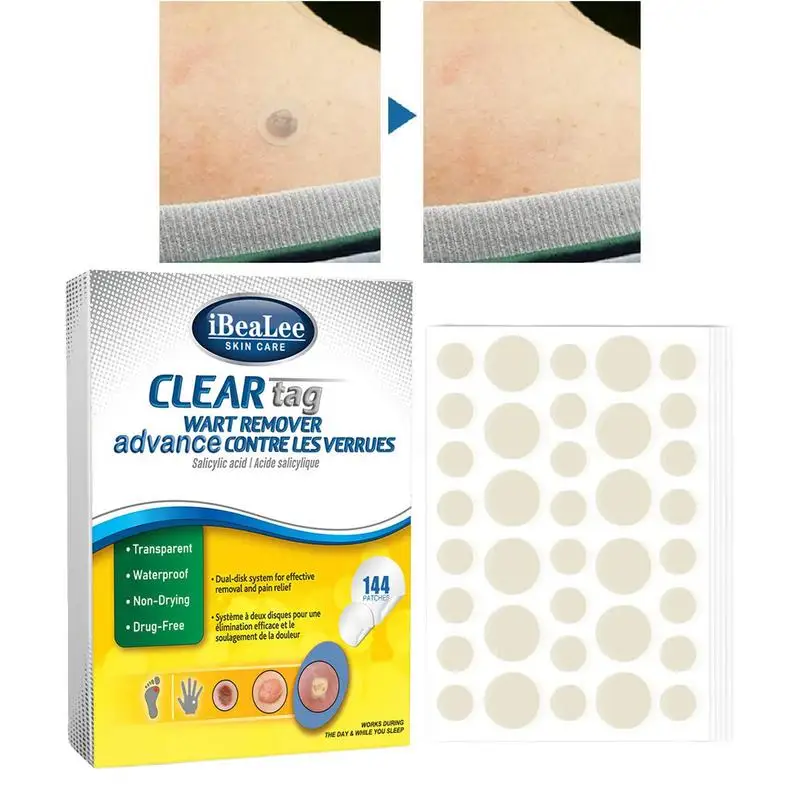 

Wart Removal Patches Flat Wart Remover Mole Treat 144pcs/box Filiform Warts Removal Skin Label Remover Corn Remove Patches