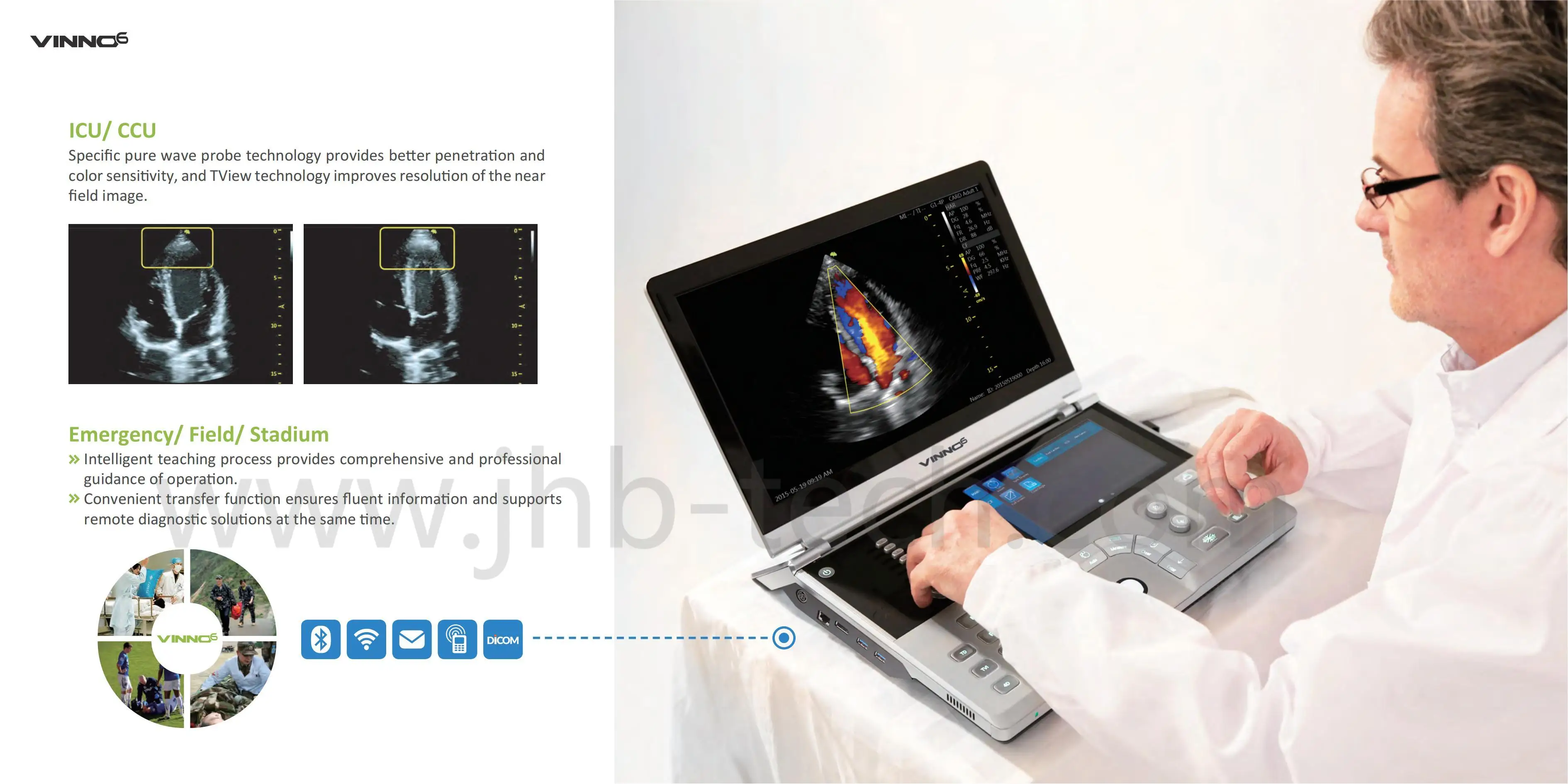 Медицинские ультразвуковые инструменты VINNO 6 портативный цветной допплер 4D