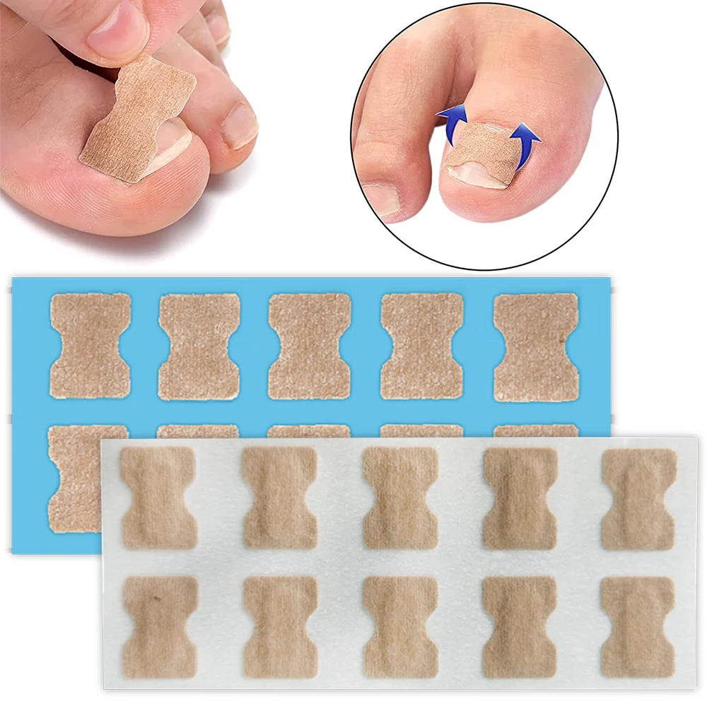 

10/50/100Pcs Ingrown Toenail Toe Correction Stickers Nails Art Foot Patch Paronychia Treatment Recover Feet Care Pedicure Tools