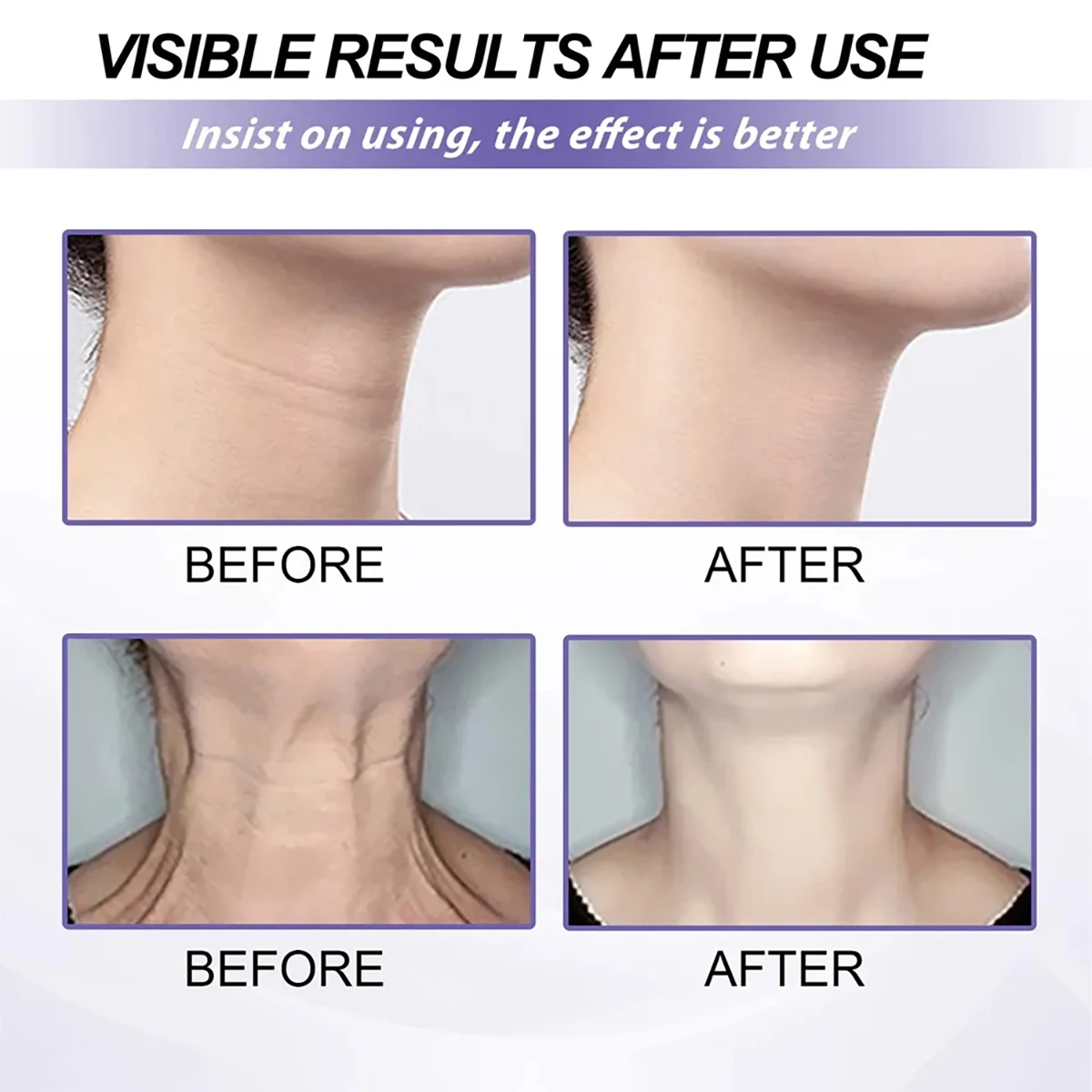 Укрепляющий крем TRSTAY выцветает с тонкими линиями способствует обновлению кожи