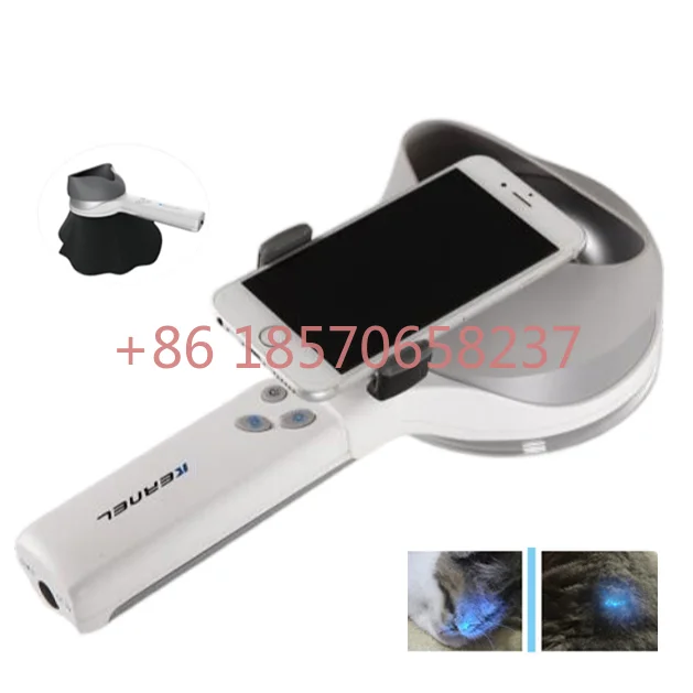 Заводская поставка, машина для анализа кожи CE, искусственная древесная лампа, анализ кожи, UVA + KN-9000B