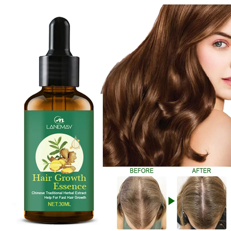 

Ginger Hair Growth Essential Oil Prevent Hair Loss Fast Growing Repair Dry Frizzy Thinning Scalp Nourish Hair Care Products 30ml