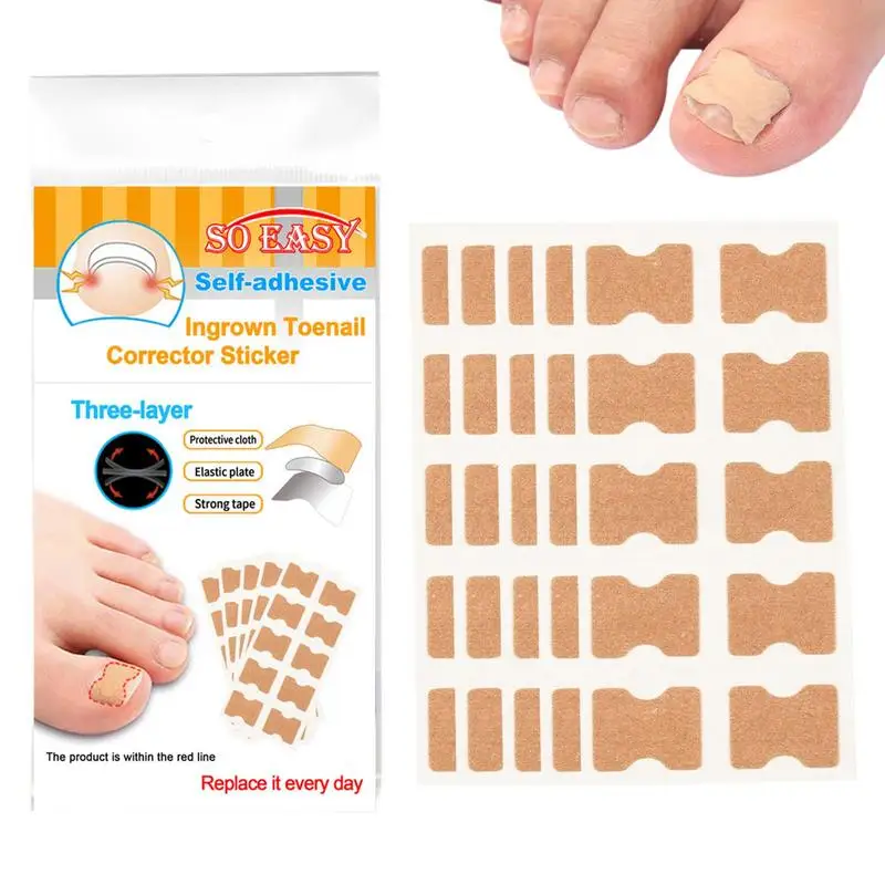 

Nail Corrector Strips 50pcs Foot Tool Curved Ingrown Toenail Corrector Sticker Professional Toenail Correction Pedicure Tool For