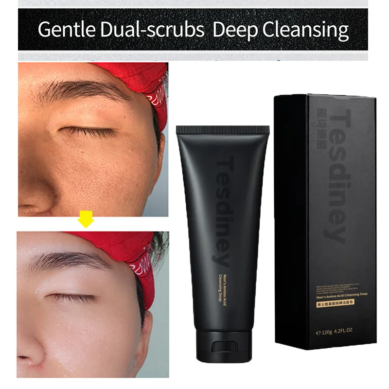 

Nose Black dots Pore Clean Nose Blackhead Remover Mask Deep Cleansing Skin Care Shrink Pore Acne Treatment Mask