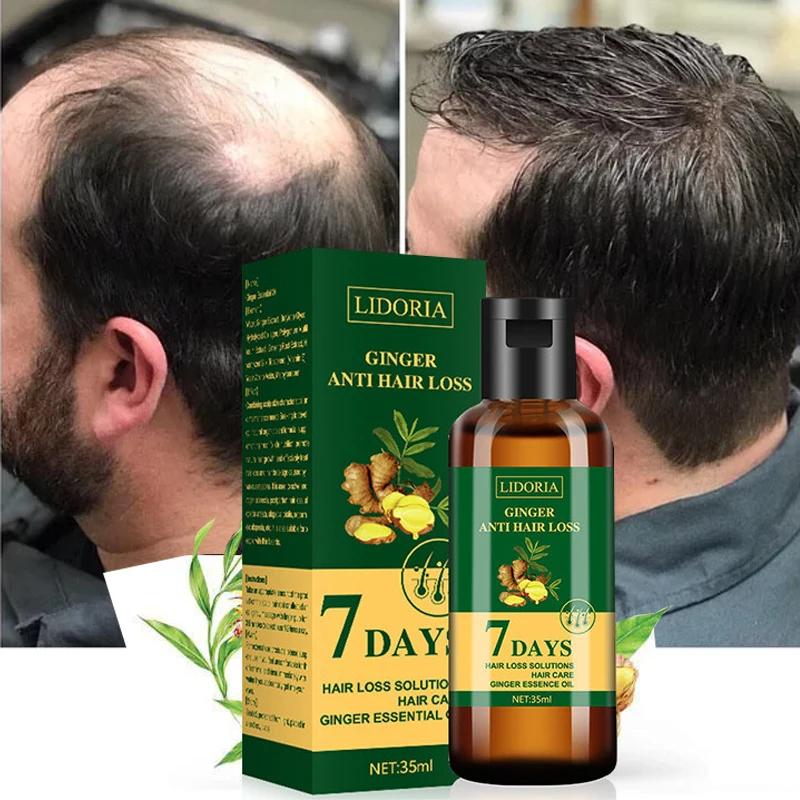 

Ginger Hair Growth Serum Effective Hair Regrowth Hair Oil Hair Growing Thicker Longer Anti-Hair Loss Products for Men Women 35ML