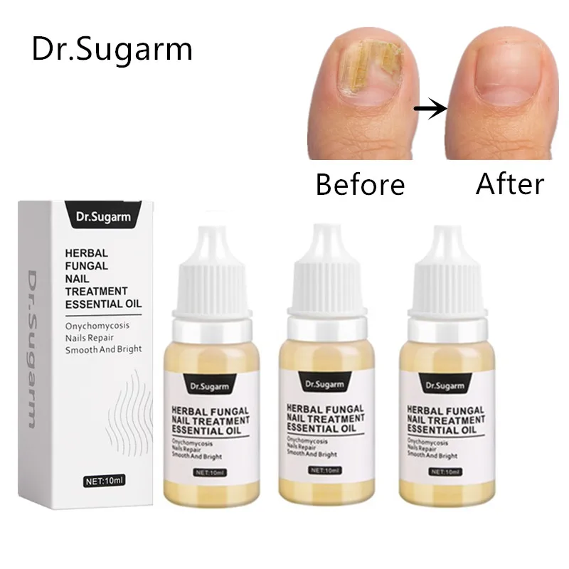 

Противогрибковая Сыворотка для ногтей, 3 шт./лот, для лечения грибка ногтей