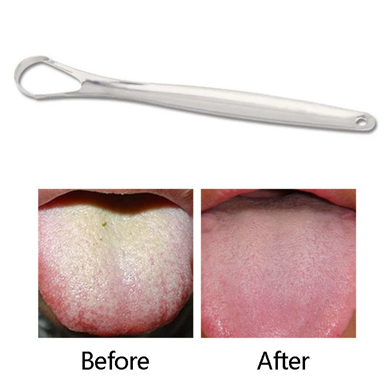 

Tongue Cleaners Fresh Breath Taste Scraper Spoon Stainless Steel Improves Digestion Oral Hygiene Beauty Health Stains Removal