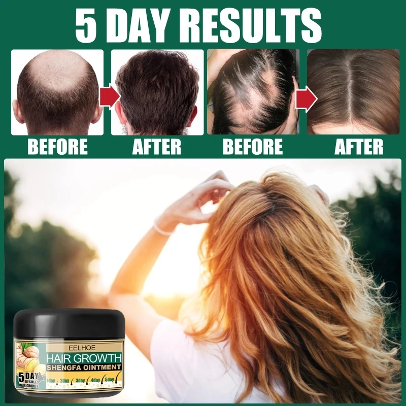 

30g Hair Growth Cream Moisturizing Scalp Massage Hair Care Essence Conditioner Treatment Hair Loss Product Series