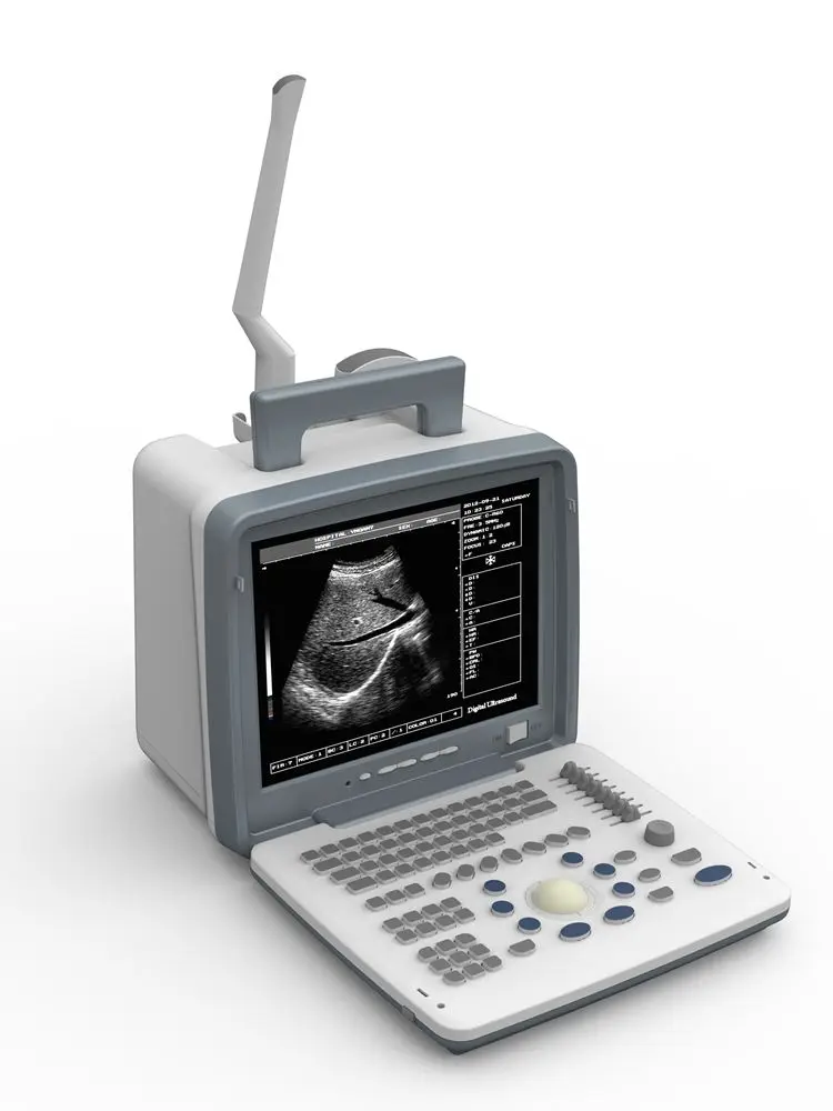 

Portable Ultrasound Scanner USG Medical Ultrasonography Machine